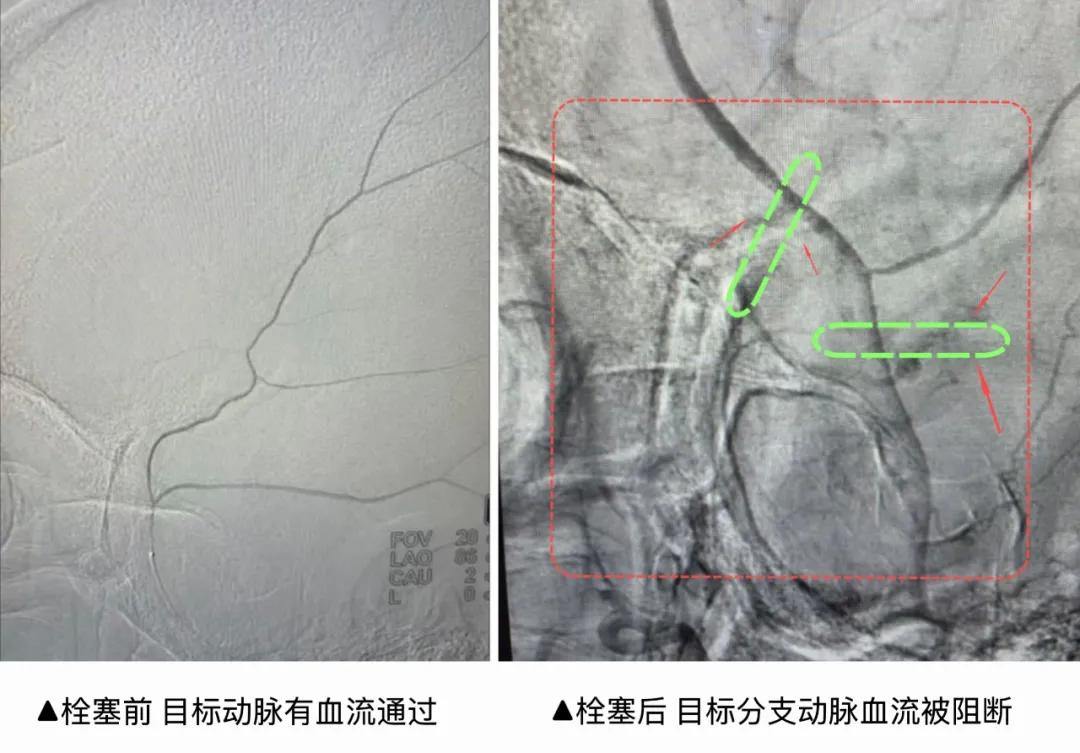 2082020076839440384.webp 图片